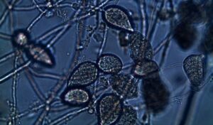 Nấm Phytophthora - Nguyên nhân gây bệnh Vàng lá thối rễ trên sầu riêng